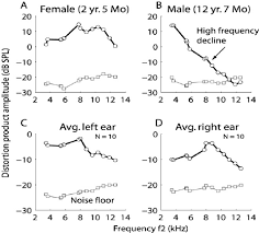 Otoacoustic Emissions (OAEs)